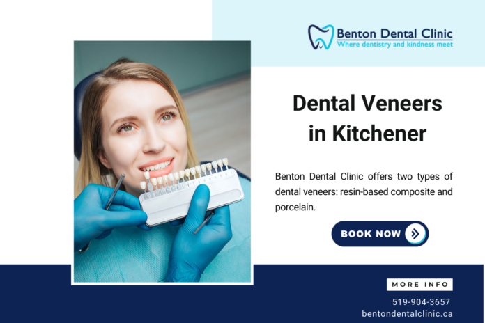 Dental Veneers in Kitchener